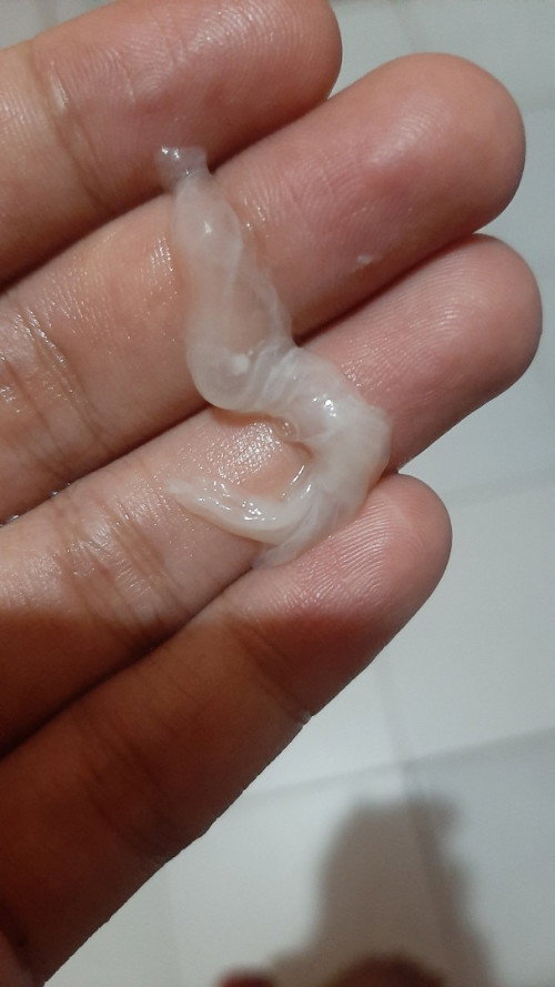 Maaf ya bun klo jorok, kenapa ya uk 37 minggu keluar lendir seperti keputihan gitu, biasanya nggk