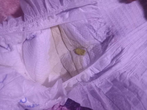 Pupu ng pupu bby ko my ubo sipon po sya at may iniinom na na gamot ok lang po ba ang pupu nya