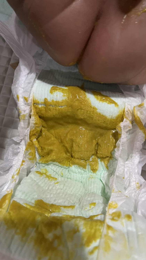 bab bayi sufor apakah normal?