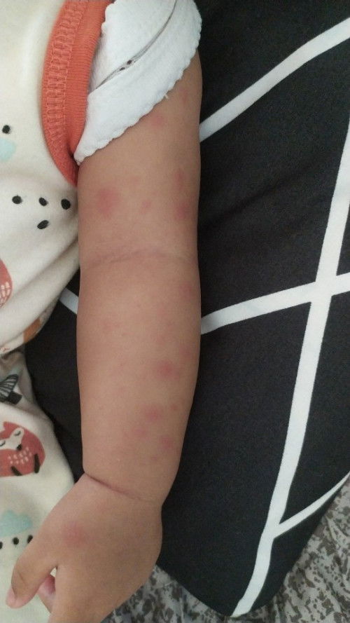 Alergi susu atau bukan