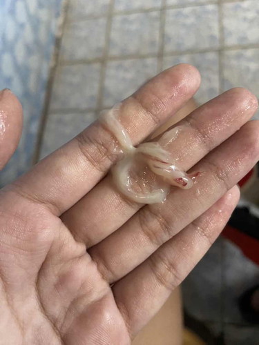 มีมูกแบบนี้ควรไป รพ เลยมั้ยคะ