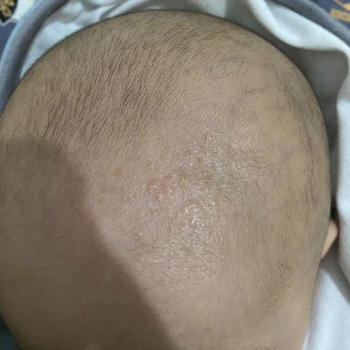 Grenjelan bayi