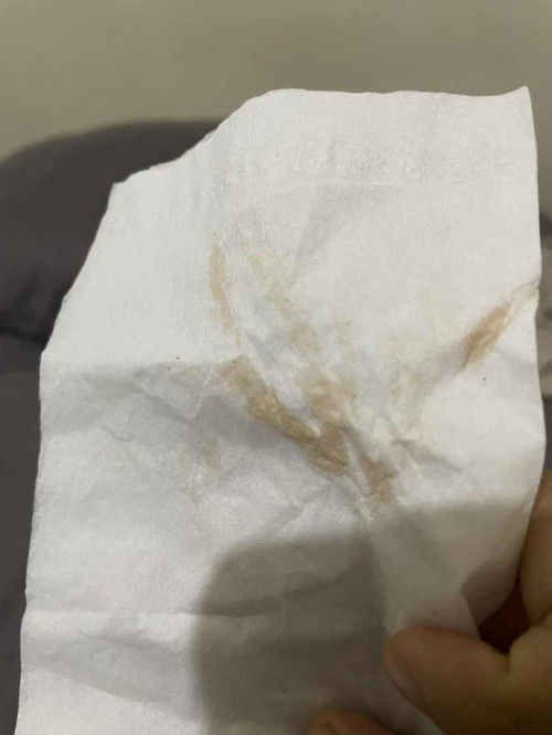 Hamil 8w keluar flek