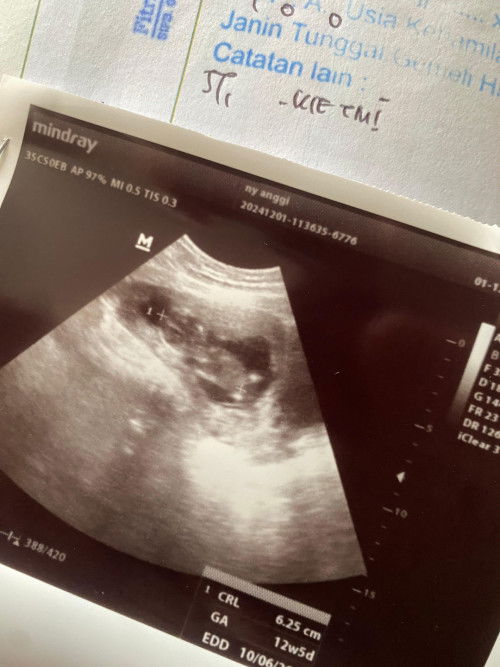 USG usia 12week