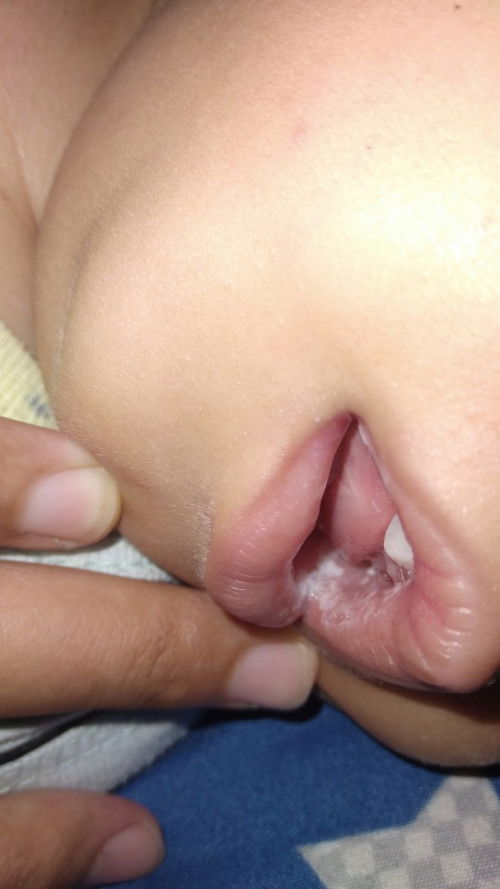 Kurang bersemangat karna anak sakit