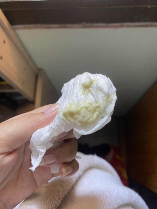สอดยากี่รอบก็กลับมาเป็นเหมือนเดิม🥲