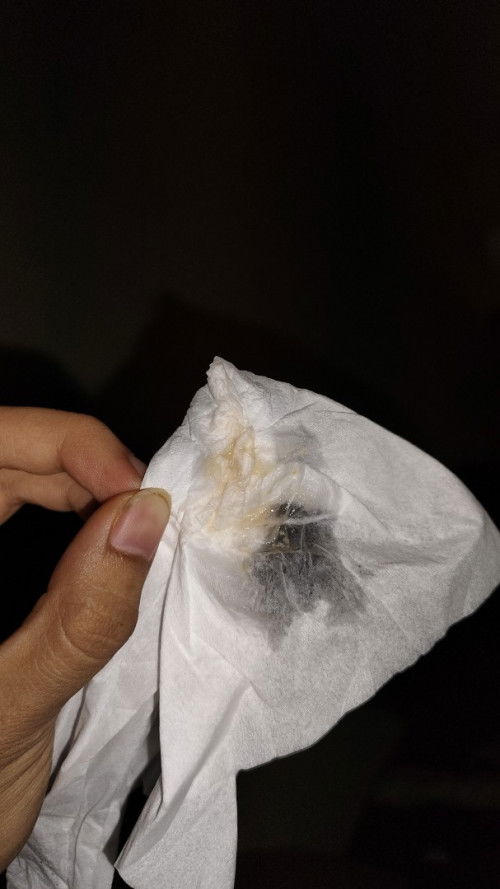 Air ketuban atau bukan ya