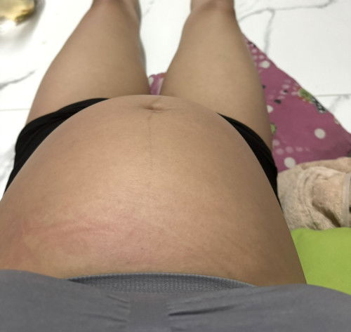 ท้อง20w5d ยังไม่ดิ้นเลยค่ะ