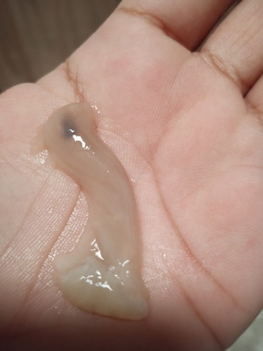 Mucus plug o wartons jelly po kaya ito??? huhu kaso 32 weeks plang po ako walang nararamdamang sakit