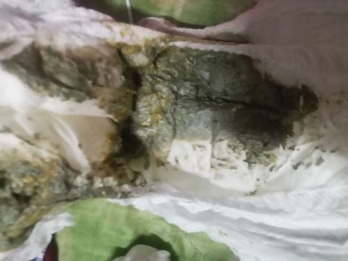 ปกติมั้ยคะแม่ๆ