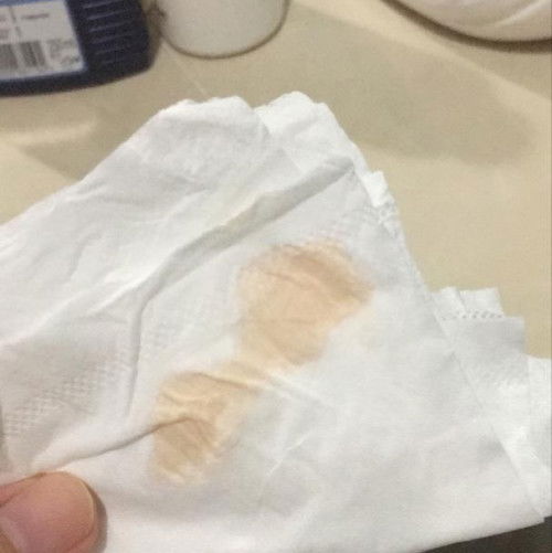 keputihan berdarah 31 minggu