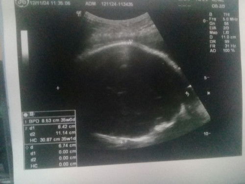 ขออนุญาตสอบถามคะแม่ๆ