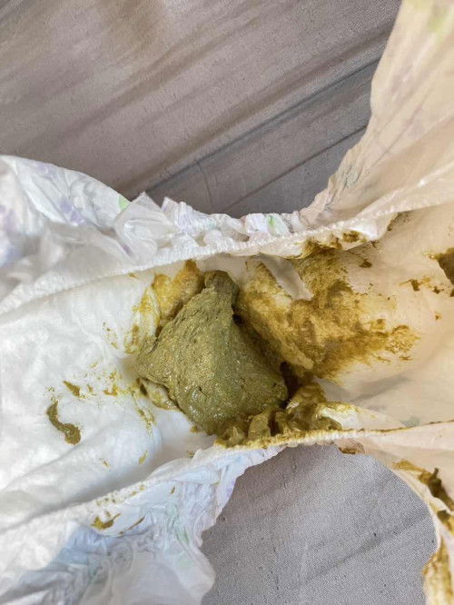 สอบถาม💩เด็ก 6 เดือน