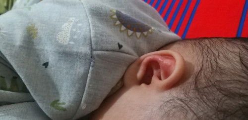 Bun mau tanya ini kenapa iya telinganya, merah kaya bruntusan. Terus cara ngilanginnya gmna?