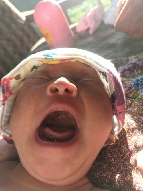 Putih2 di langit mulut