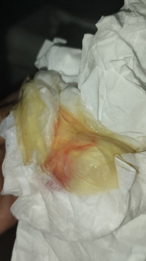 enaknya kapan ke klinik bersalin ya