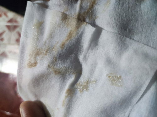 Hello po bloody show po ba itong brownish discharge and sign na malapit na manganak ?