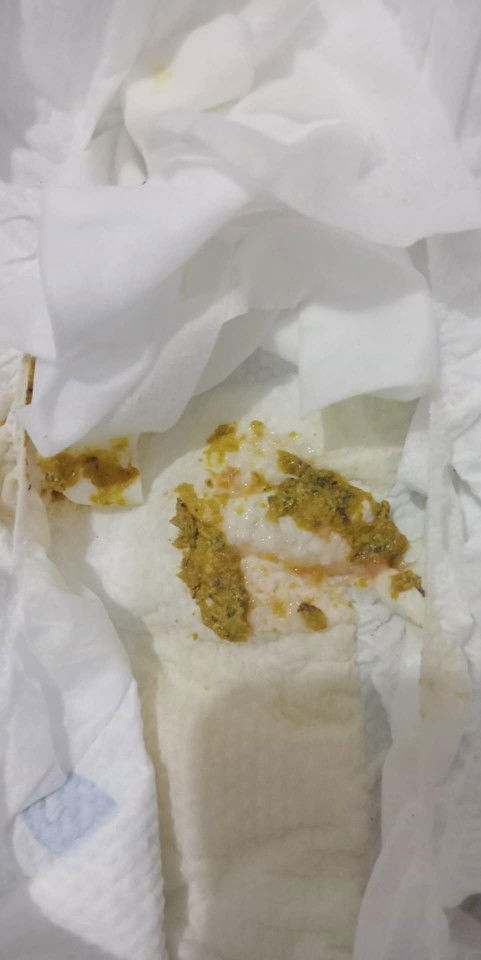 Pupu na may dugo,normal lang po ba ang ganitong pupo ?pang 1 day na po kase nila yan pahelp po ty