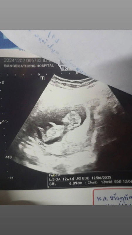 ในใบอัลตร้าซาวด์บอกว่าอะไรบ้างค่ะ