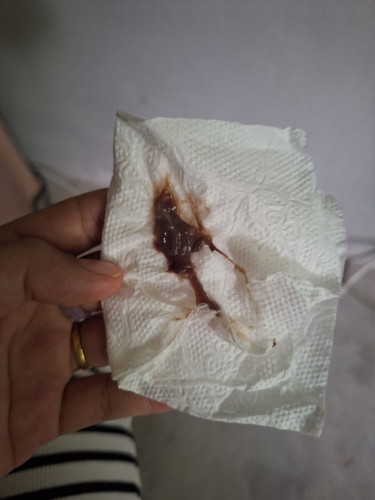 มูกเลือดหรืออะไรค่ะ