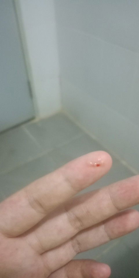 มีเลือดออกแบบนี้ทำไงคะ