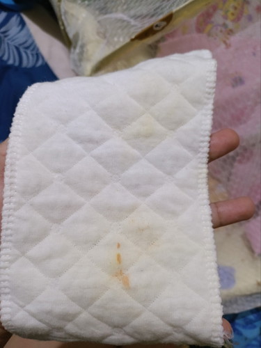 Keluar darah dari anus bayi