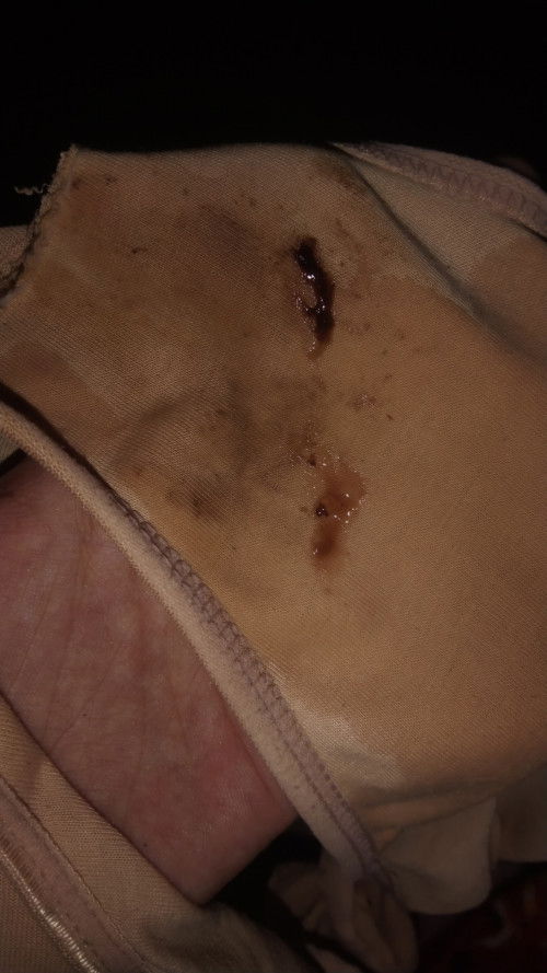 Ada yang sama gak ya pengalaman hamil 38 Minggu keluar lendir coklat sudah 3 hari ini.?