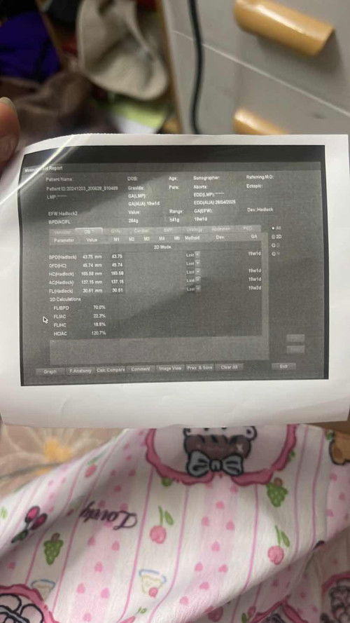 เพศลูกก 19+1