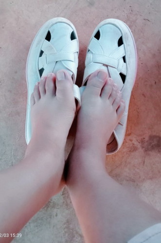 34+6w. บวมแบบนี้อันตรายมั้ยคะ