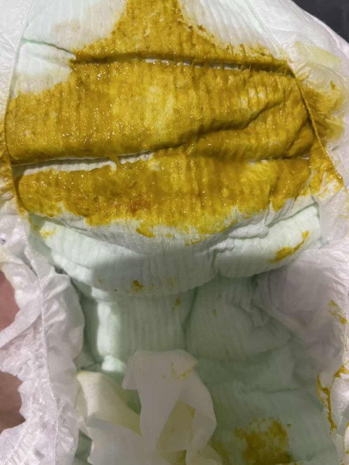 Bayi pup ada bercak darah