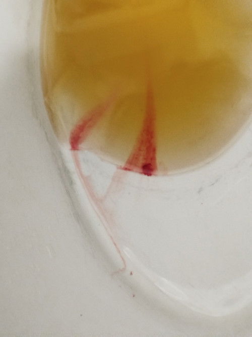 Pls answer po mga mima