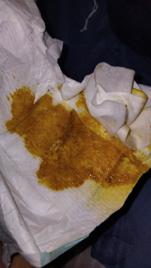 Apakah ini termasuk diare?