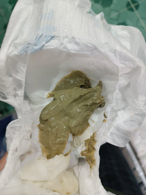 Bby mnum enfalac baby ge..normal x najis mcm ni..bby 4 month..sya rsau.