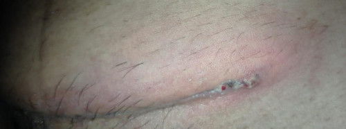 Ada yg pernah ngalamin? Maaf fotonya agak"🥲