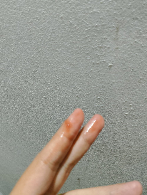39+3 ใช่มูกเลือดไหมคะ