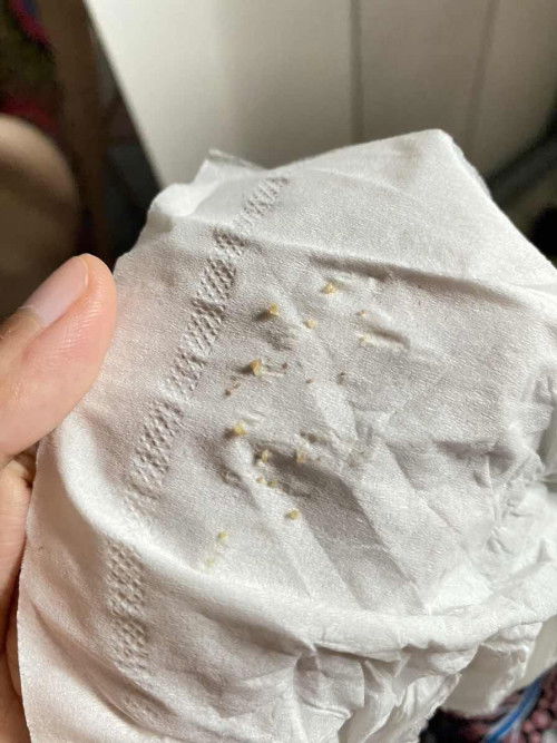 Usia kehamilan 33 weeks