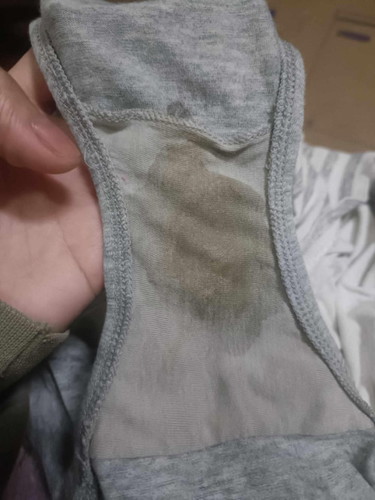 Vaginal Discharge