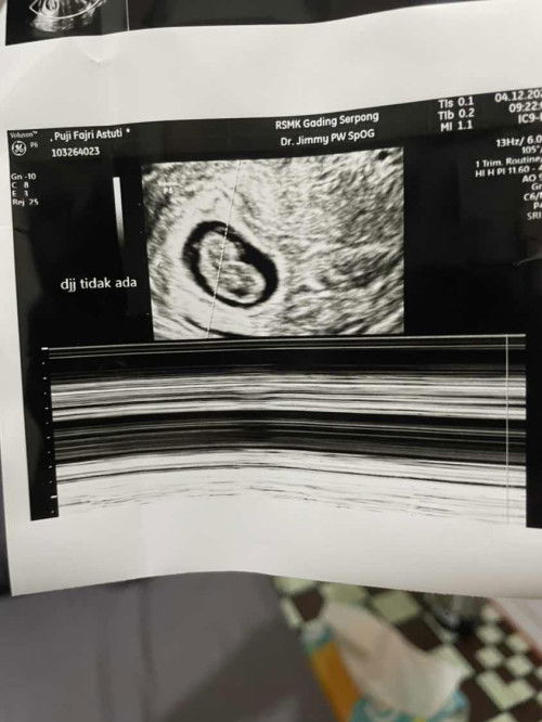 Selang 2 hari djj udah ga ad