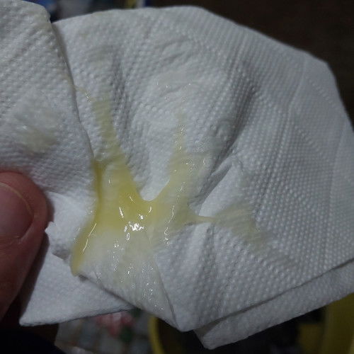 มูกหลังคลอด