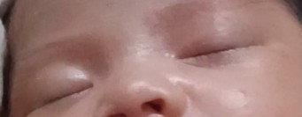 Ini tanda bayi sy dehidrasi gak ya? Ada solusi kah Bun?