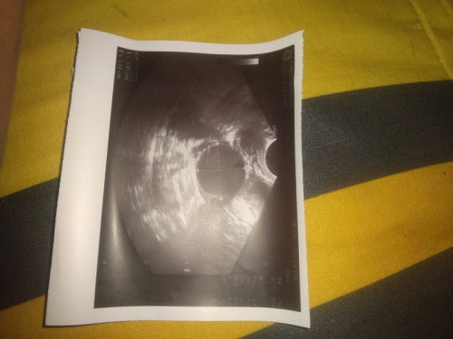 แม่ๆคิดว่าท้องงไหมค่ะ