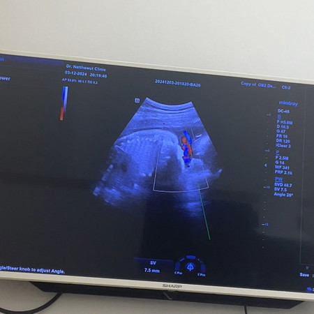 ขอกำลังใจค่ะ รกพันคอลูก