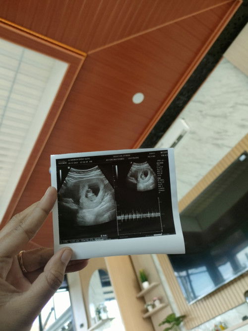 10 weeks , sehat sehat ya de