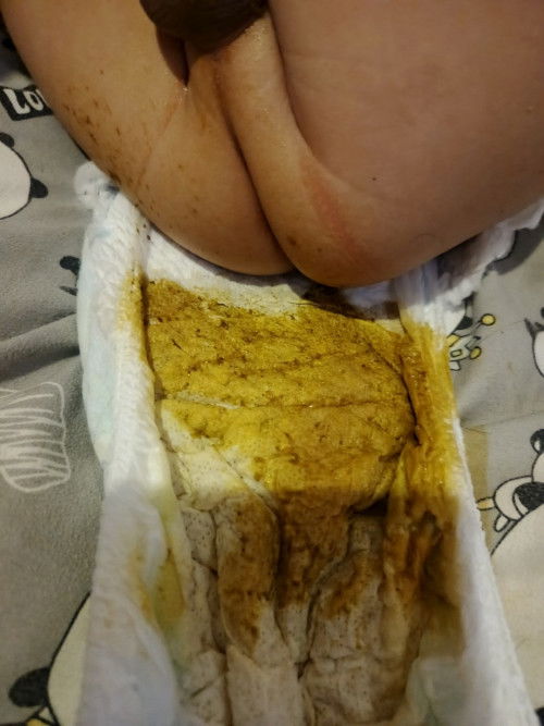 Bab cair pada bayi 5 bulan