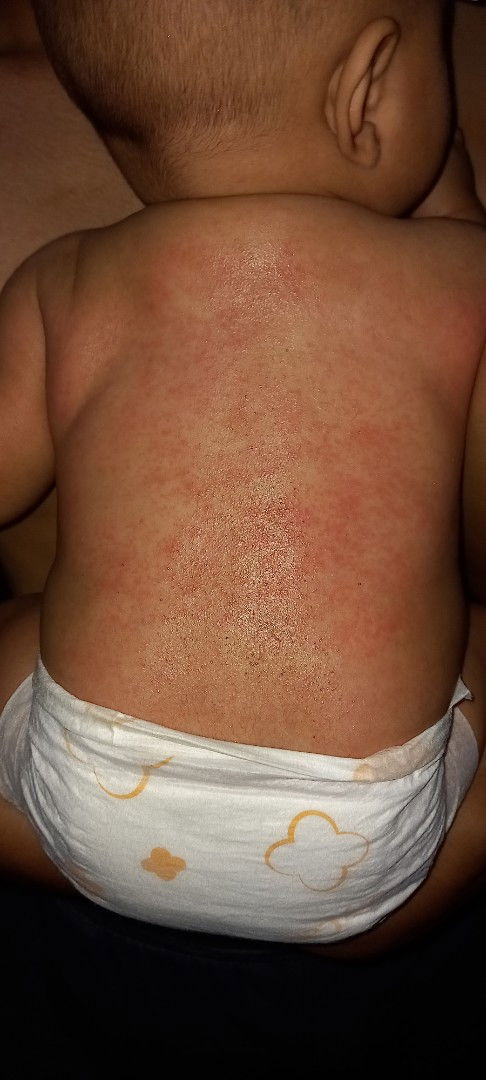 Ada yang ngalamin kayak gini nga bun??