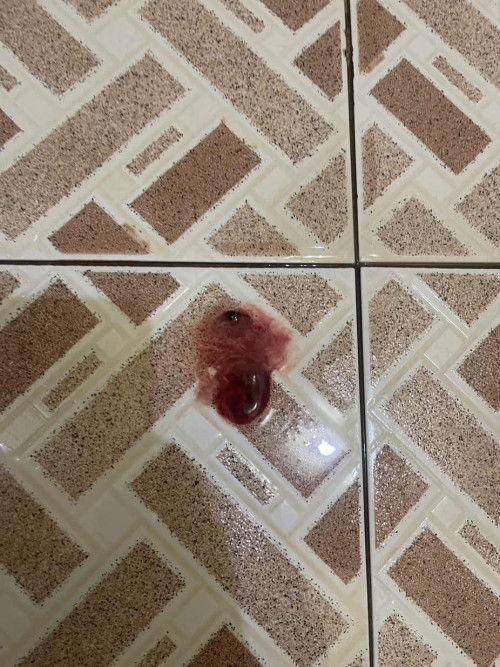 apakah ini pertanda persalinan segera terjadi?