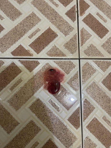 apakah ini pertanda persalinan segera terjadi?