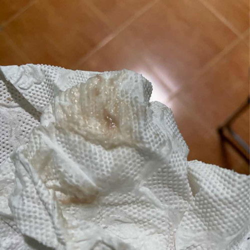 มีตกขาวสีน้ำตาลอ่อนแบบนี้อันตรายไหม?