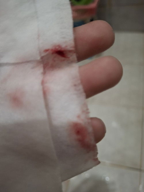 มีเลือดแบบนี้ แต่ไปหาหมอแล้วเขาว่าไม่เป็นอะไรเกิดจากอะไรได้บ้างคะ