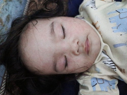 Wajah bayi seperti alergi